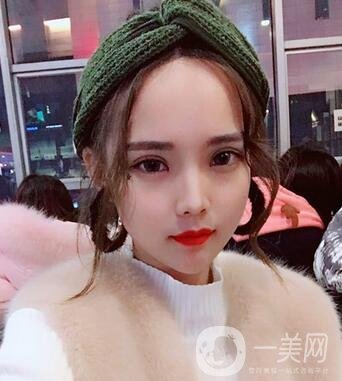 湖南第一醫(yī)院整形科價(jià)格表，附雙眼皮案例