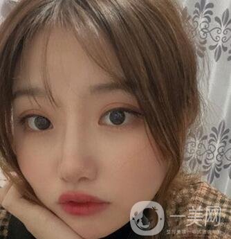 青島青醫(yī)附院整形價格表，還有雙眼皮實例