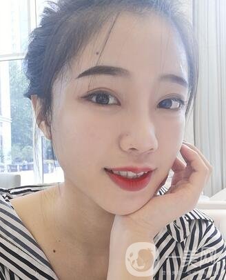 哈爾濱醫(yī)大二院美容科隆鼻*果咋樣?附價(jià)格表一覽