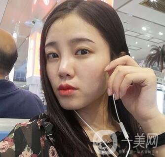 哈爾濱醫(yī)大二院美容科隆鼻*果咋樣?附價(jià)格表一覽