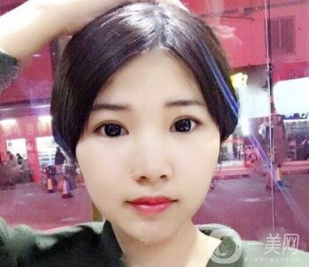 聊城市人民醫(yī)院整形科價格表及*案例一覽