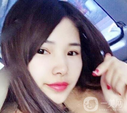 聊城市人民醫(yī)院整形科價格表及*案例一覽