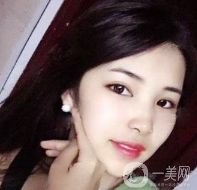 聊城市人民醫(yī)院整形科價格表及*案例一覽