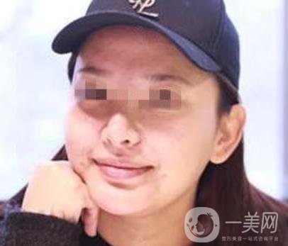 西南醫(yī)院*多少錢?附整形價格表及真實(shí)案例