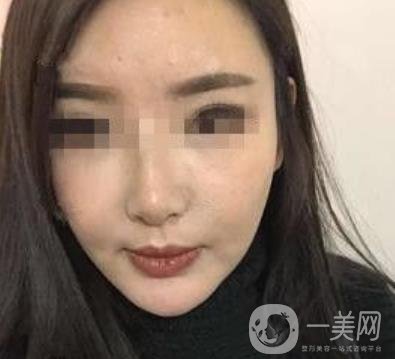 西南醫(yī)院*多少錢?附整形價格表及真實(shí)案例