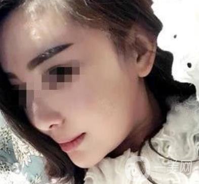 西南醫(yī)院*多少錢?附整形價格表及真實(shí)案例