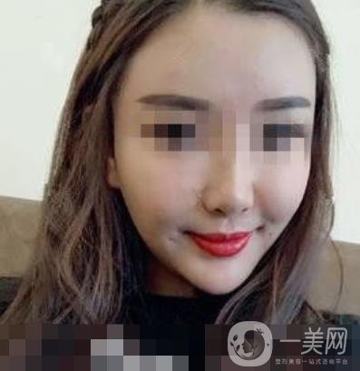 西南醫(yī)院*多少錢?附整形價格表及真實(shí)案例