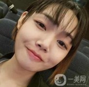 西京整形科價(jià)格表收費(fèi)標(biāo)準(zhǔn)多方面一覽！含專(zhuān)家雙眼皮案例術(shù)后照~