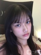 廣州曙光整形醫(yī)院隆鼻價(jià)格新版出爐！專家案例分享~真實(shí)點(diǎn)評(píng)