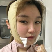 湘雅三醫(yī)院整形科價格表全新出爐！磨骨案例果圖同步公開~