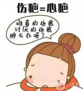 成都疤痕修復醫(yī)院介紹？應該怎么選？