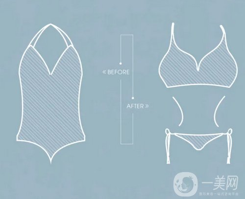 假體豐胸,假體豐胸價格,天津假體豐胸價格