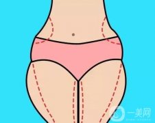 抽脂好還是溶脂好？合適人群有哪些？