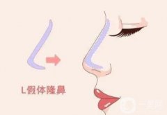 隆鼻后怎么護(hù)理能長(zhǎng)期保持果?