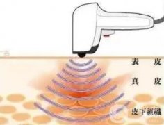 為什么熱拉提要連續(xù)做三次？