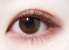 割雙眼皮后會(huì)經(jīng)歷哪些？