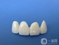 洗牙牙齒會(huì)松動(dòng)嗎？怎么護(hù)理烤瓷牙？