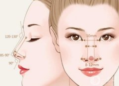 隆鼻有哪些方法?