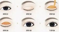 雙眼皮手術(shù)恢復(fù)需要多長(zhǎng)時(shí)間？