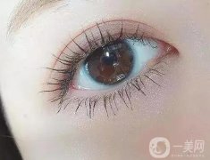 如何能夠避免割雙眼皮的失??？