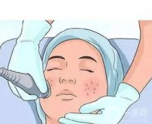 都有哪些類型呢？做一次能持續(xù)多長(zhǎng)時(shí)間?