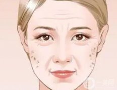 哪些方法祛斑會(huì)導(dǎo)致毀容？