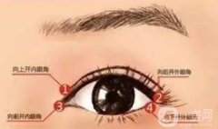 做外眼角會回縮嗎？會反彈嗎？應該怎么護理？