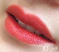 自體脂肪豐唇一般需要多少錢？