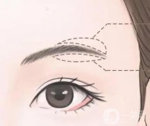 切眉手術后會很快衰老嗎