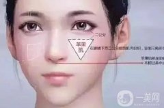 填充蘋果肌有什么方法？