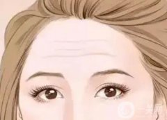 怎么去除抬頭紋才有？