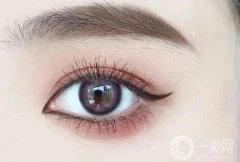 需要修復雙眼皮的情況有哪些？