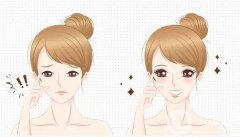 雙眼皮可以做第二次嗎？