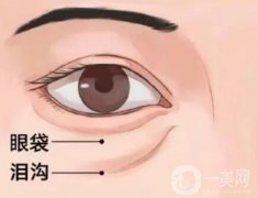 去眼袋手術(shù)適合什么季節(jié)做？