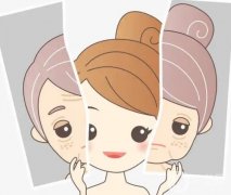 彩光嫩膚有什么果？對皮膚有什么傷害嗎？