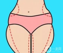 抽脂沒有瘦的原因是什么？如何控制體重?