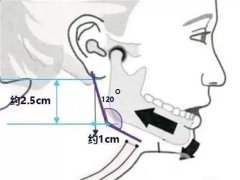 切骨好不好？有哪些危害？