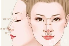 隆鼻修復(fù)需要多少錢？哪些人可以做隆鼻修復(fù)？