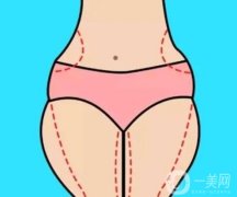 小腿抽脂疼嗎？恢復(fù)需要多長(zhǎng)時(shí)間？