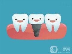 種植牙的壽命可以怎么延長(zhǎng)？