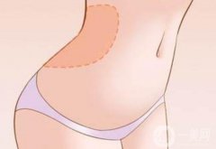 全身吸脂手術(shù)不適合哪些人？