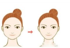 整容的風(fēng)險(xiǎn)有哪些？