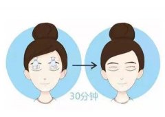 做雙眼皮失敗的可能性大嗎？