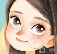 人造酒窩有哪些禁忌癥？