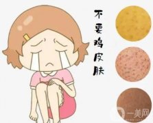 雞皮膚可以紋身嗎？危害有哪些