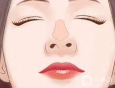 鼻尖肥大可以縮小嗎？