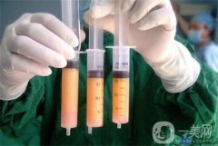 腹部吸脂整形要多少錢(qián)？