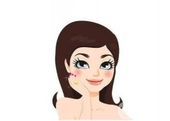 全身嫩膚果好嗎?多少錢(qián)一次?