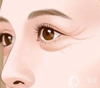 眼部除皺手術主要有哪些，特點是什么