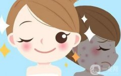 光子嫩膚的性怎么樣？